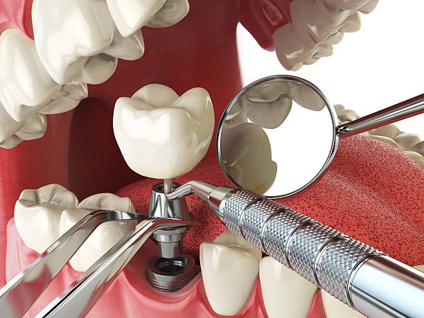 Best Same-Day Emergency Dental Services in Centreville, VA